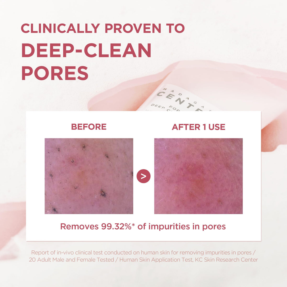 SKIN1004 Poremizing Deep Cleansing Foam side view showing packaging