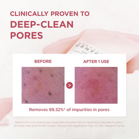 SKIN1004 Poremizing Deep Cleansing Foam side view showing packaging