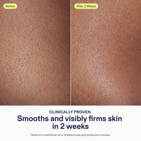 Skinfix AHA/BHA Renewing Body Cream ingredients list