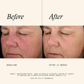 SkinMedica Retinol Serum 0.25 Complex application on skin