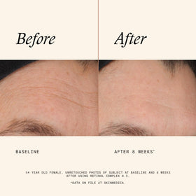 SkinMedica Retinol Serum 0.5 Complex application on skin