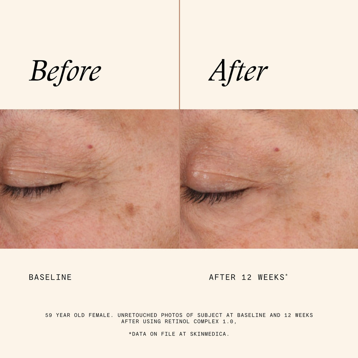 SkinMedica Retinol Serum 1.0 Complex close-up of bottle