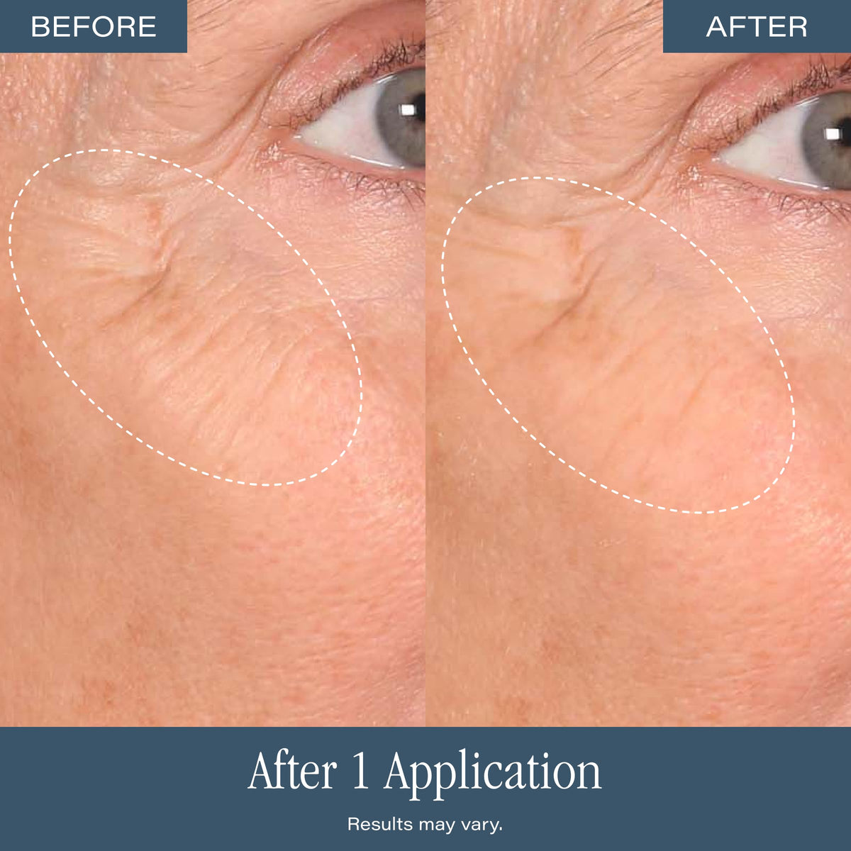 SKINN DermAppeal Microdermabrasion Facial Scrub on a vanity