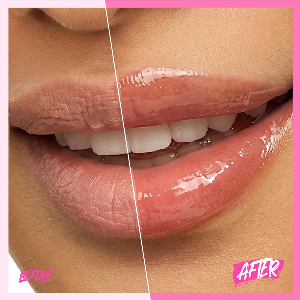 SKINTIFIC Brightening Lip Serum 30g with glossy finish on lips