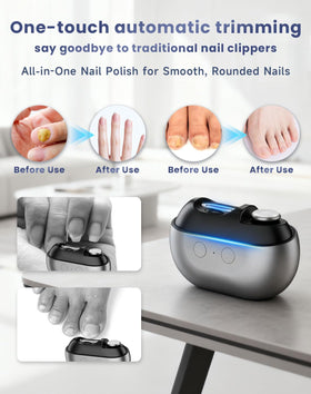 soglude Electric Nail Clippers in use on thick toenails