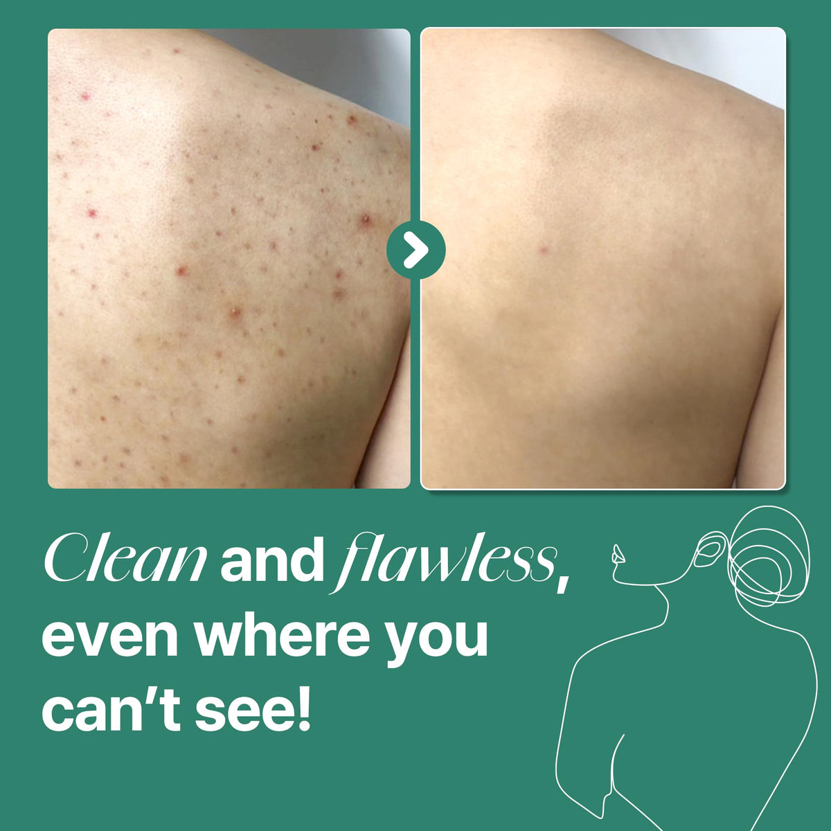 SOME BY MI body wash lathering on skin