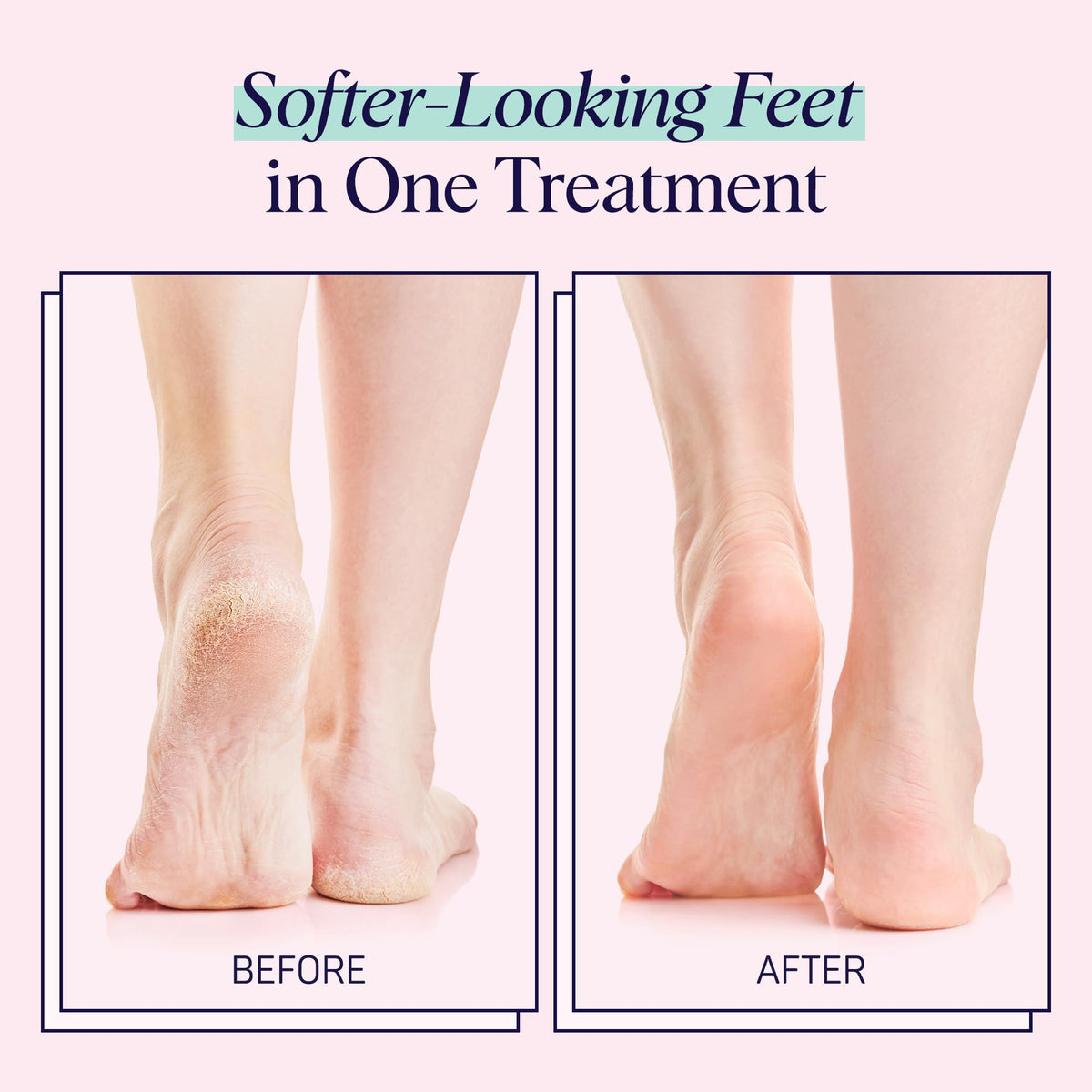 SpaLife foot mask application scene