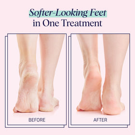 SpaLife foot mask application scene