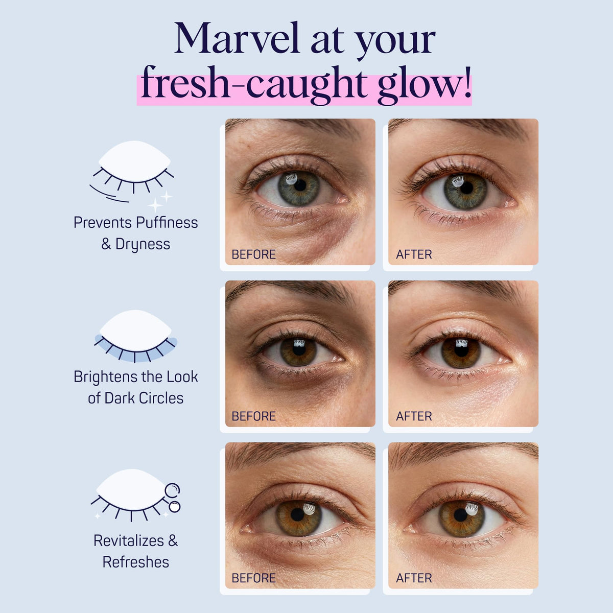 SpaLife under eye patches with hyaluronic acid and niacinamide