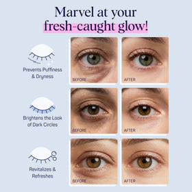 SpaLife under eye patches with hyaluronic acid and niacinamide