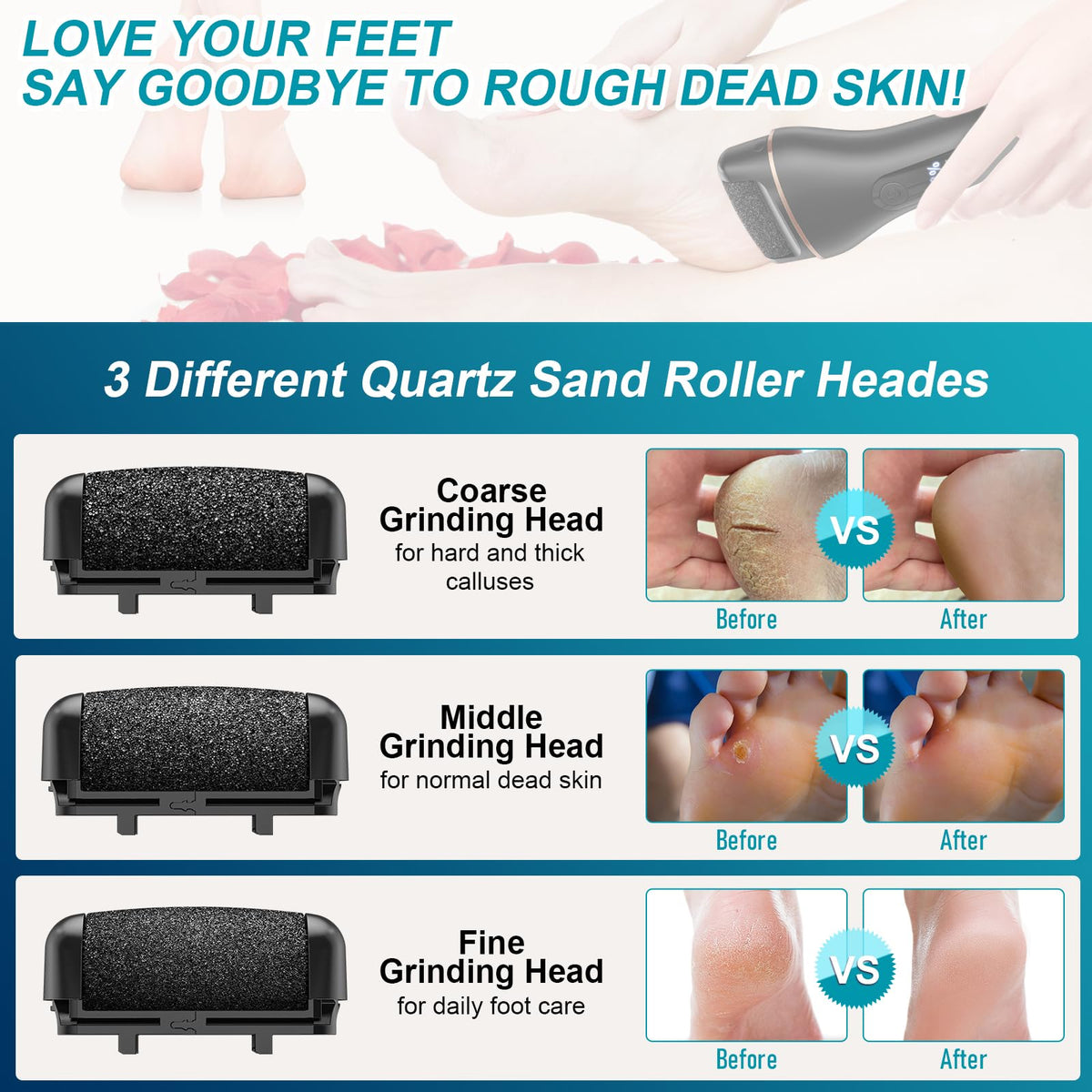 Spriak Callus Remover LCD display showing speed settings