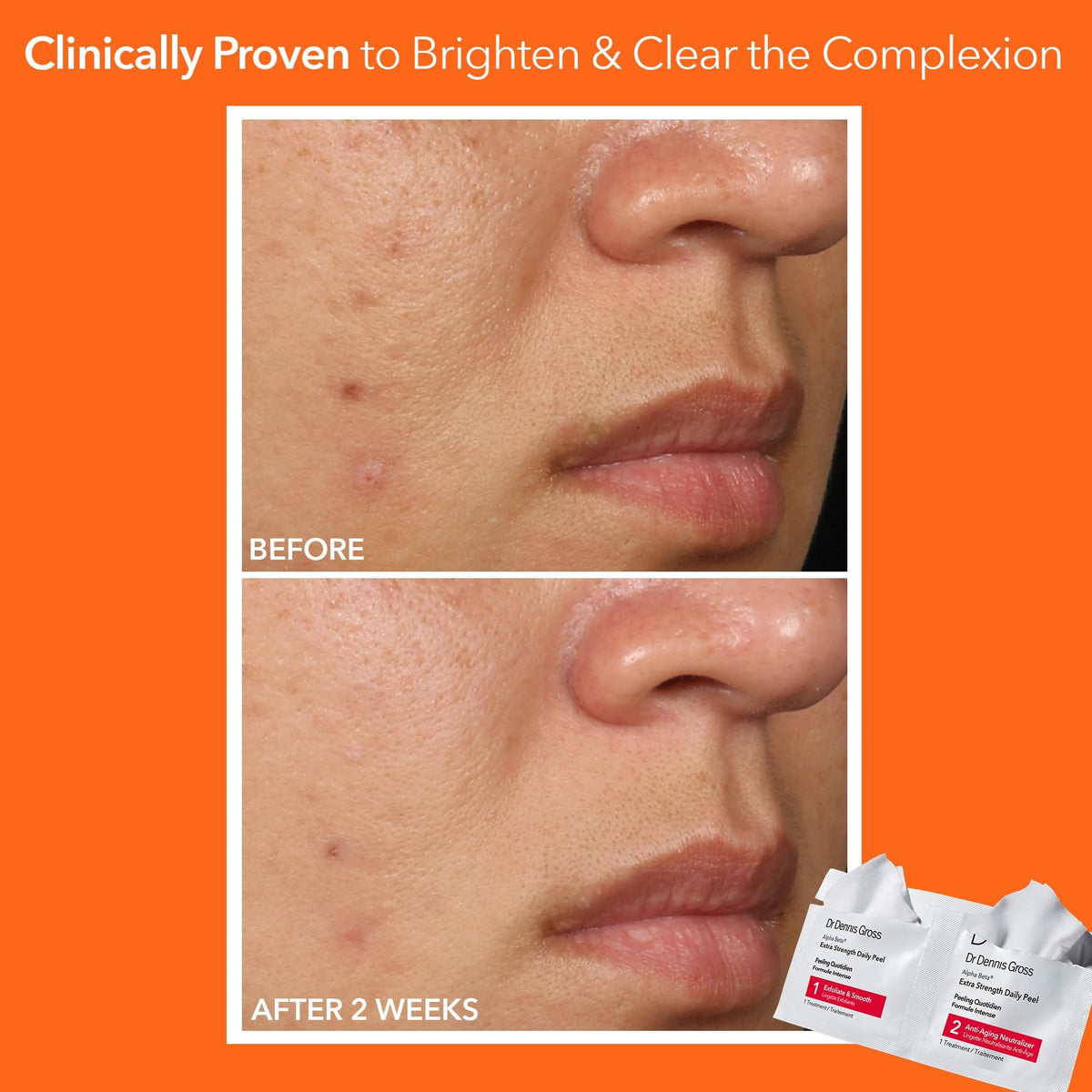 Step 2 of Dr Dennis Gross Alpha Beta Peel application on skin