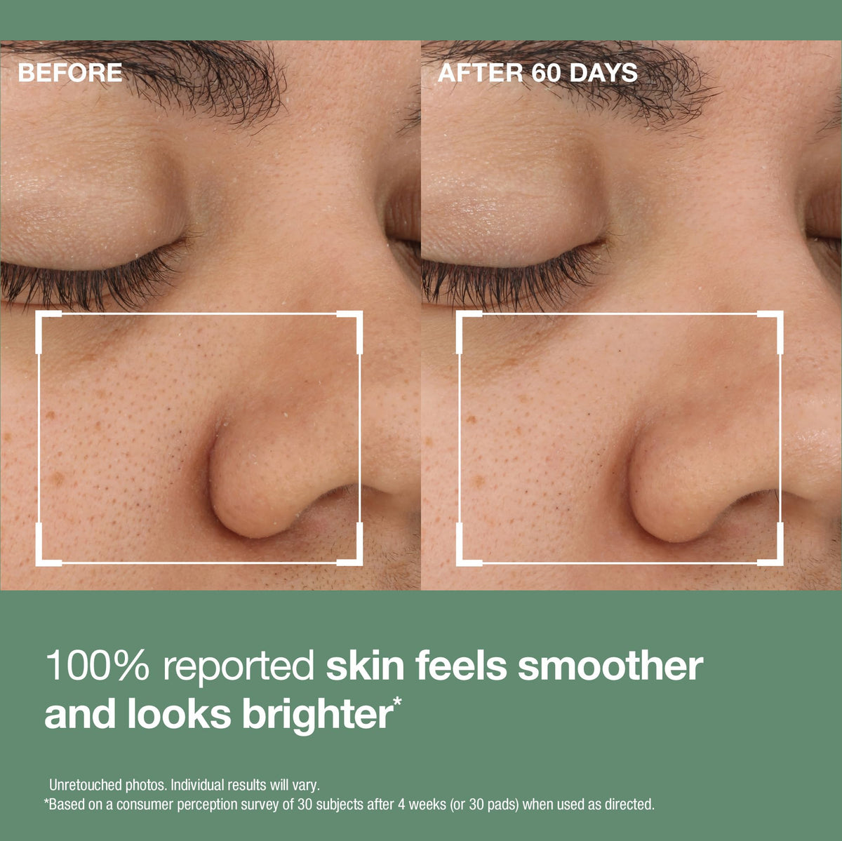 StriVectin Daily Reveal Exfoliating Face Pads on a bathroom counter