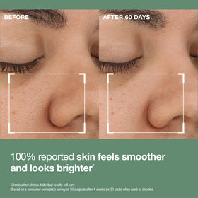 StriVectin Daily Reveal Exfoliating Face Pads on a bathroom counter