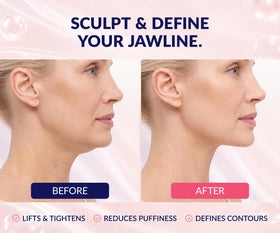 Stylia V Line Lifting Collagen Mask application on model