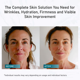 SUN COAST SCIENCES Total Package Serum being applied to skin