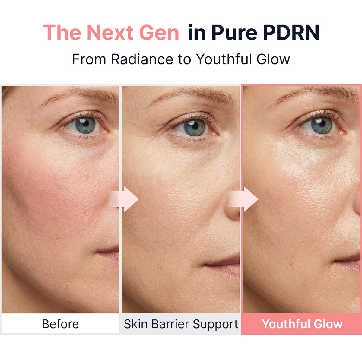 SUNGBOON EDITOR Glow Intensive PDRN Ampoule with packaging