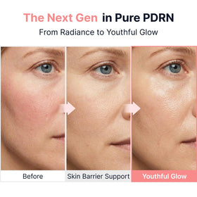 SUNGBOON EDITOR Glow Intensive PDRN Ampoule with packaging