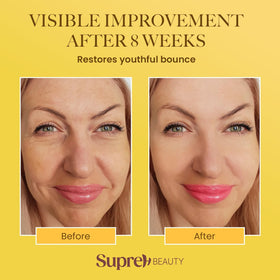 SupreH Bee Venom Wrinkle Cream packaging details