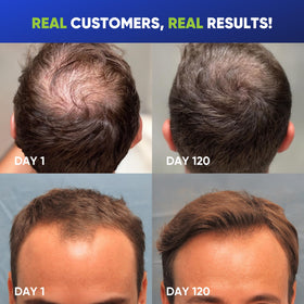 Svvimer Hair Growth Shampoo side view highlighting bottle design