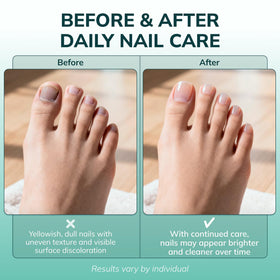 Swissklip KlearNail Toenail Stick side view showing dimensions