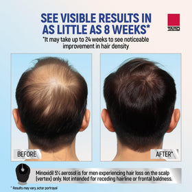 TARO Minoxidil Foam 5% with measuring cap