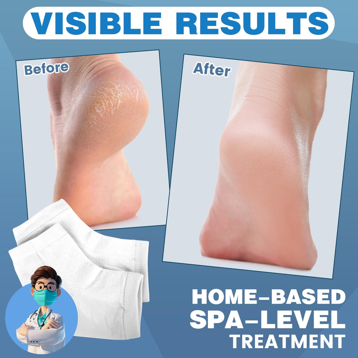 TEAWOO heel socks showing moisturizing gel lining