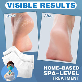 TEAWOO heel socks showing moisturizing gel lining