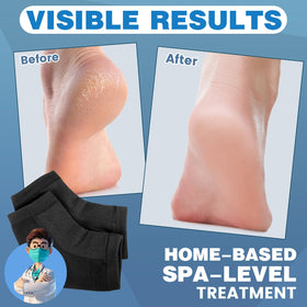 TEAWOO heel socks showing toeless design and gel lining