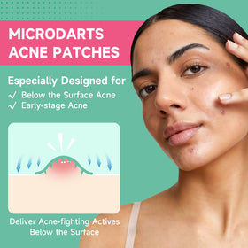 TEAWOO Microdart Acne Patch close-up showing microdart technology