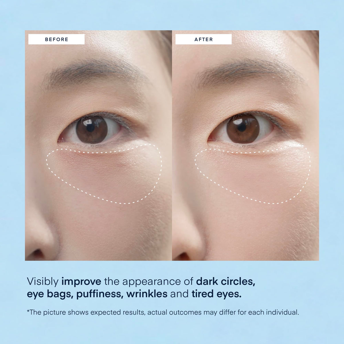 TEREZ & HONOR under eye patches in use during self-care routine
