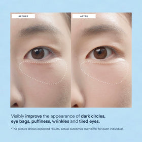 TEREZ & HONOR under eye patches in use during self-care routine