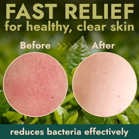 Terramed Antibacterial Body Scrub in a bathroom setting