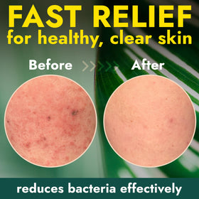 Terramed Antibacterial Body Wash showing product texture