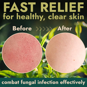 Terramed Antifungal Body Scrub packaging details
