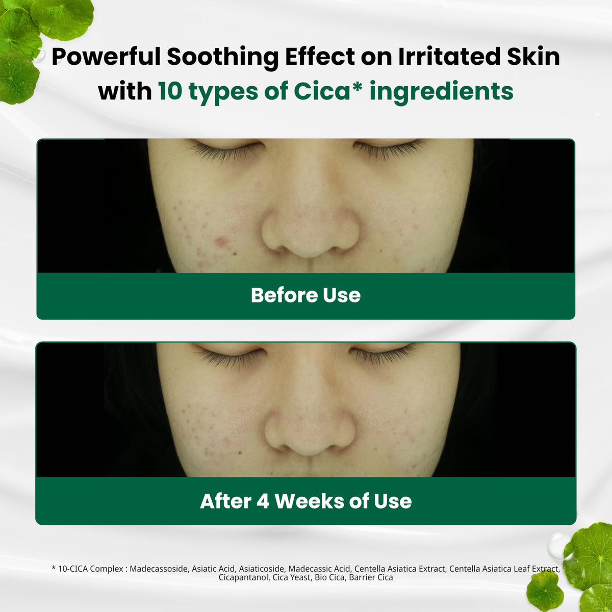 Texture of Dr.G Red Blemish Clear Soothing Moisturizer Cream on a hand