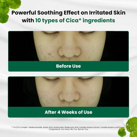 Texture of Dr.G Red Blemish Clear Soothing Moisturizer Cream on a hand