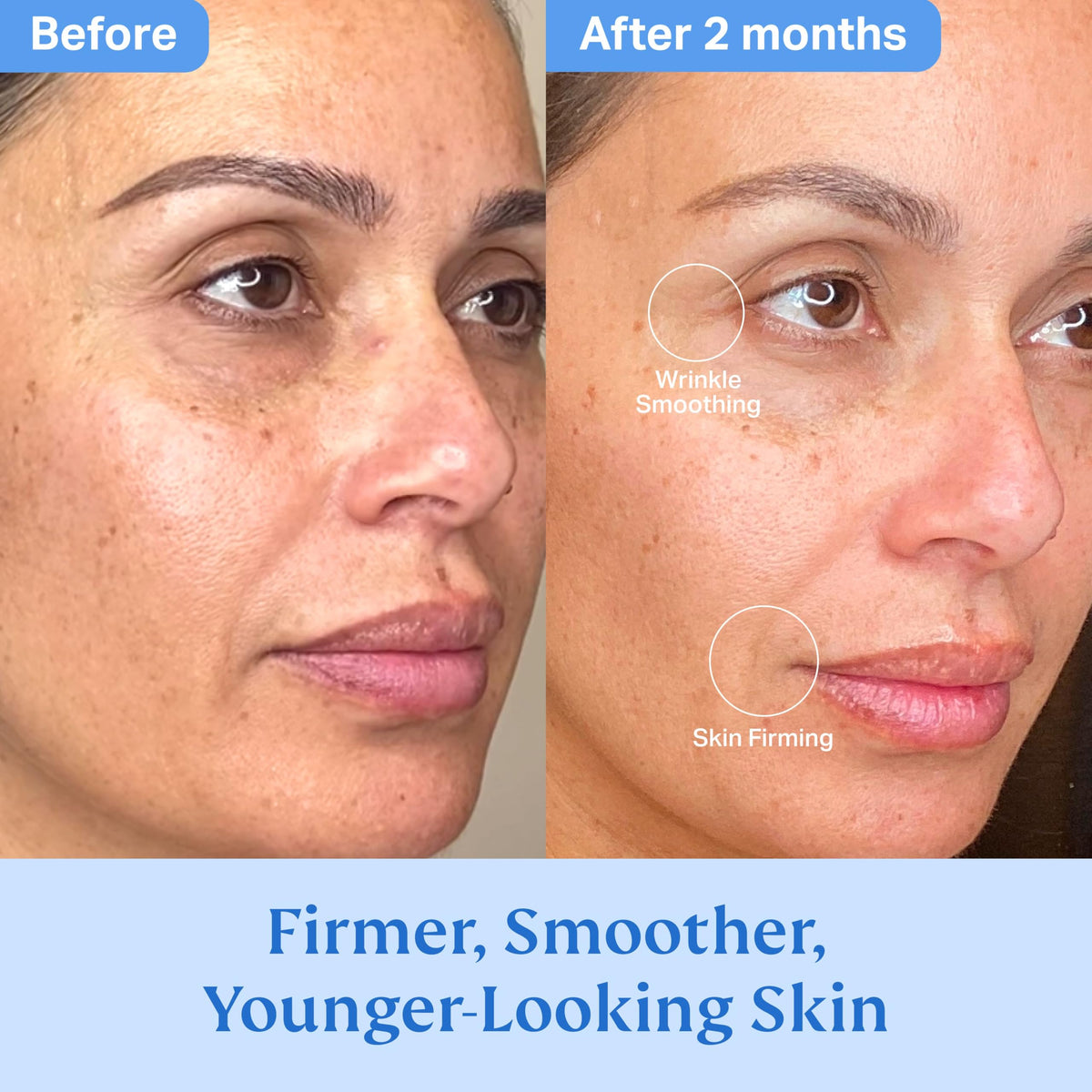 Texture of HYDRONOVA Total Rewind Sculpting Serum on skin