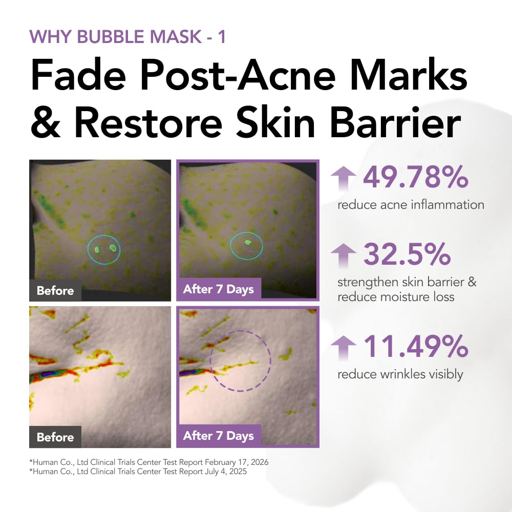 Texture of MENOKIN Bubble Mask on skin