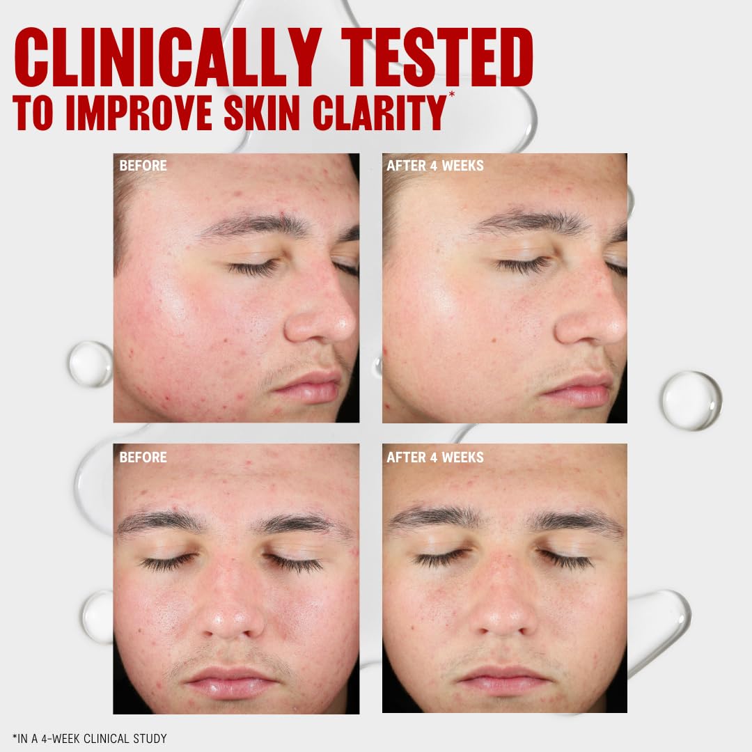 THAYERS Blemish Clearing Toner in bathroom setting