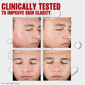 THAYERS Blemish Clearing Toner in bathroom setting