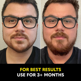 The Beard Club Beard Growth Vitamins on a wooden surface