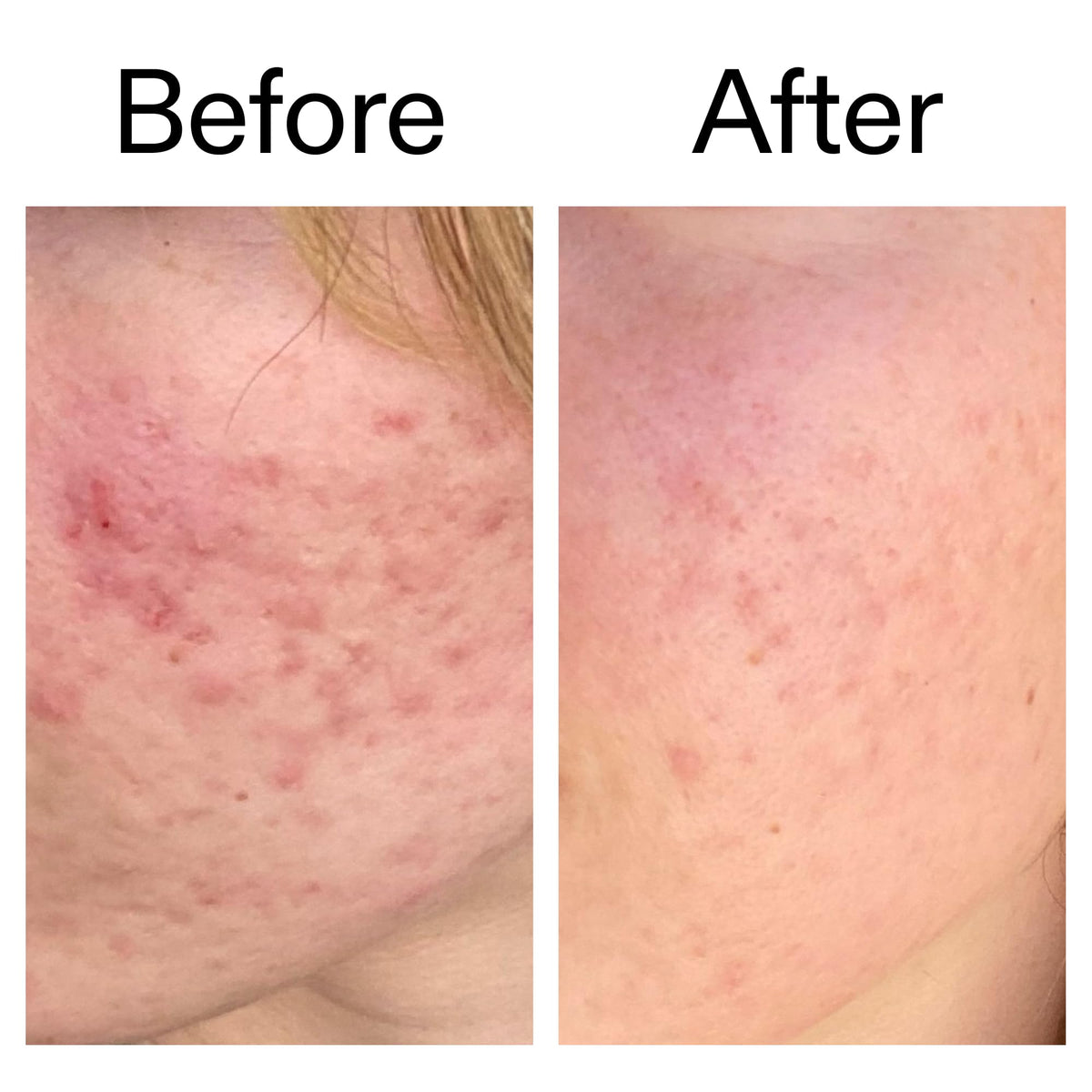 The INKEY List Azelaic Acid Serum packaging details