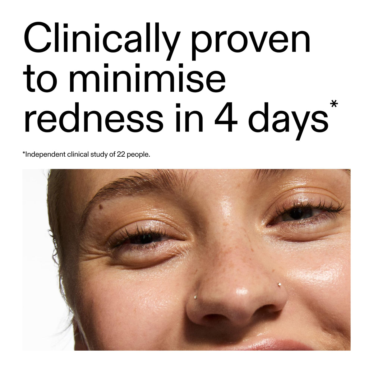 The INKEY List Azelaic Acid Serum texture on hand