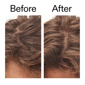 The INKEY List Glycolic Acid Scalp Scrub ingredients list