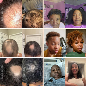 The Mane Attraction Extra-Strength Herbal Hair Growth Oil lifestyle scene