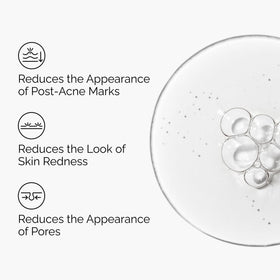 The Ordinary Aloe 2% + NAG 2% Solution texture on skin