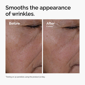 The Ordinary Multi-Peptide + Hyaluronic Acid Serum application on skin