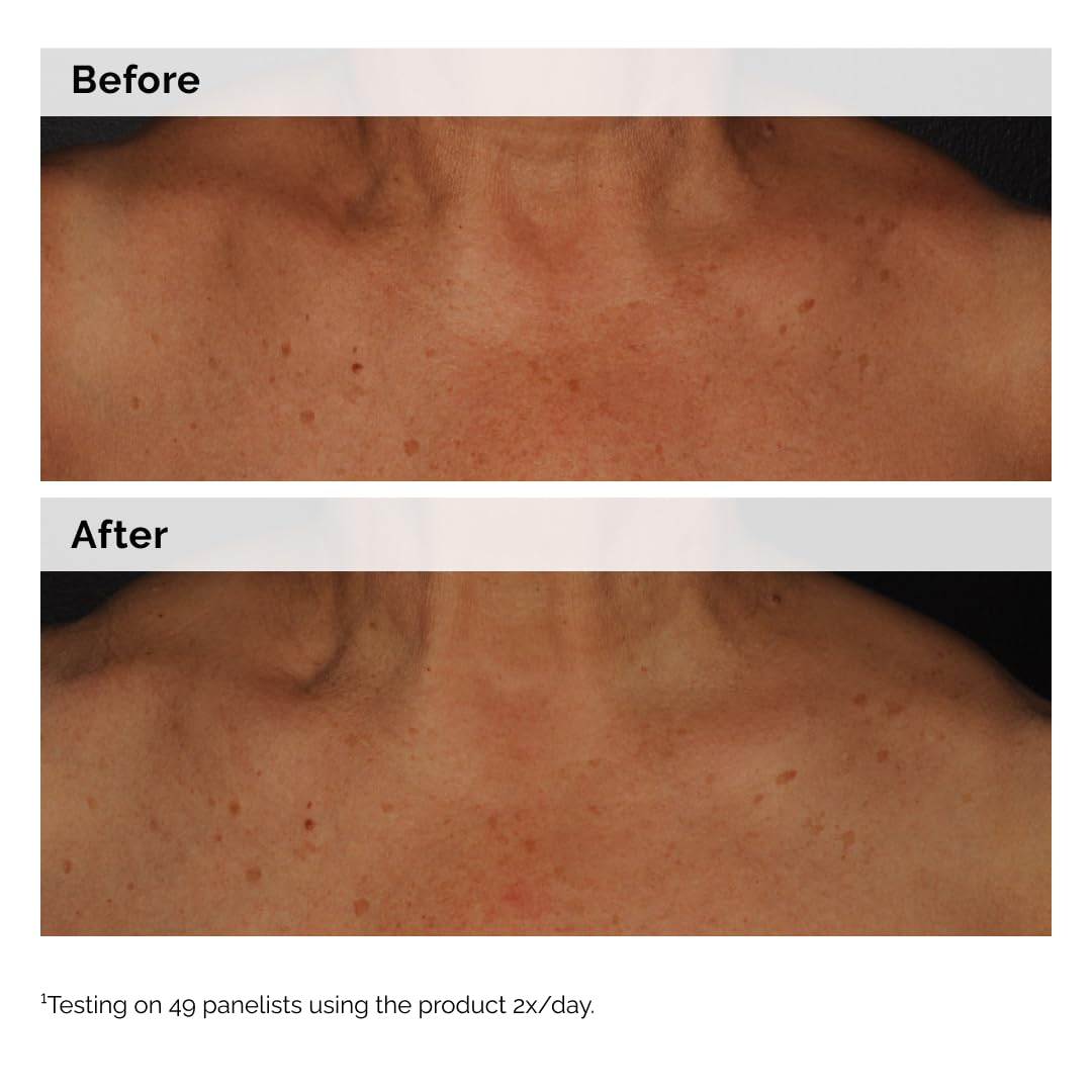The Ordinary Niacinamide 5% Emulsion with skincare routine