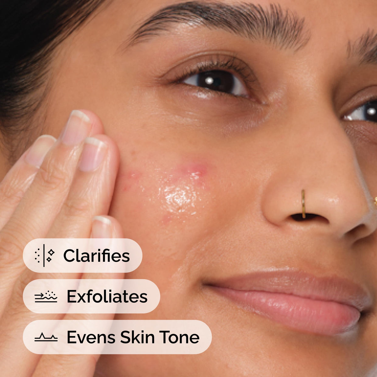 The Ordinary Salicylic Acid 2% Anhydrous Solution in a skincare routine